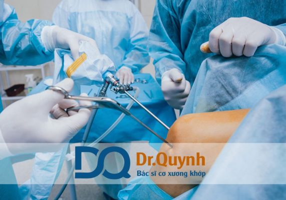 Review mổ dây chằng chéo trước ở bệnh viện 115 Mổ dây chằng chéo trước tại Bệnh viện 115 là lựa chọn hàng đầu cho nhiều bệnh nhân bị chấn thương thể thao, tai nạn giao thông hay tai nạn sinh hoạt.