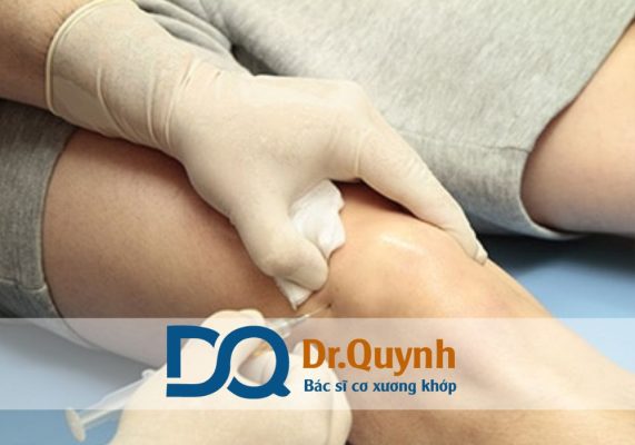 Tiêm chất nhờn khớp gối bao nhiêu tiền Tiêm chất nhờn khớp gối là phương pháp an toàn, hiệu quả trong điều trị thoái hóa khớp gối giai đoạn sớm và trung bình