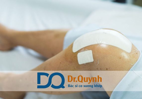 Review chi phí thay khớp gối Bệnh viện Việt Đức Việt Đức là lựa chọn an toàn, chất lượng, đáng tin cậy cho bệnh nhân miền Bắc cần phẫu thuật thay khớp gối.