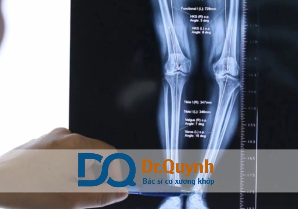 Việc được hưởng BHYT khi phẫu thuật là mối quan tâm lớn của người bệnh và gia đình