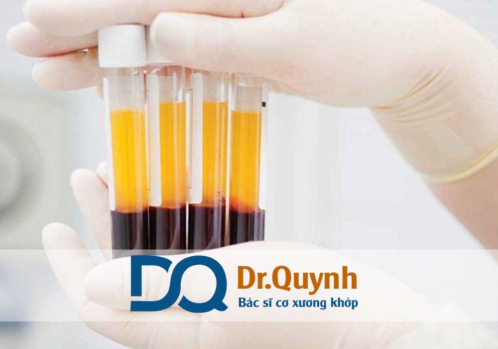 CHUYÊN GIA, BÁC SĨ CKI LÊ VĂN QUỲNH là địa chỉ đáng tin cậy, giúp hàng ngàn bệnh nhân quay lại với đam mê thể thao, duy trì sức khỏe cơ xương khớp bền vững.