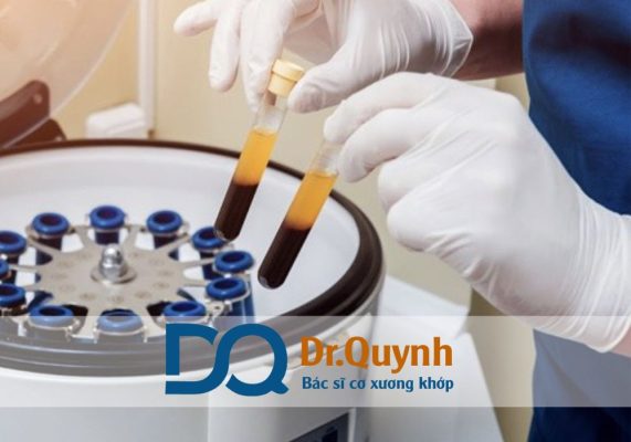 So sánh chi phí tiêm huyết tương giàu tiểu cầu và phẫu thuật Sự lựa chọn đúng đắn không chỉ giúp bạn tiết kiệm hàng trăm triệu đồng, mà còn bảo toàn sức khỏe và chất lượng sống lâu dài.