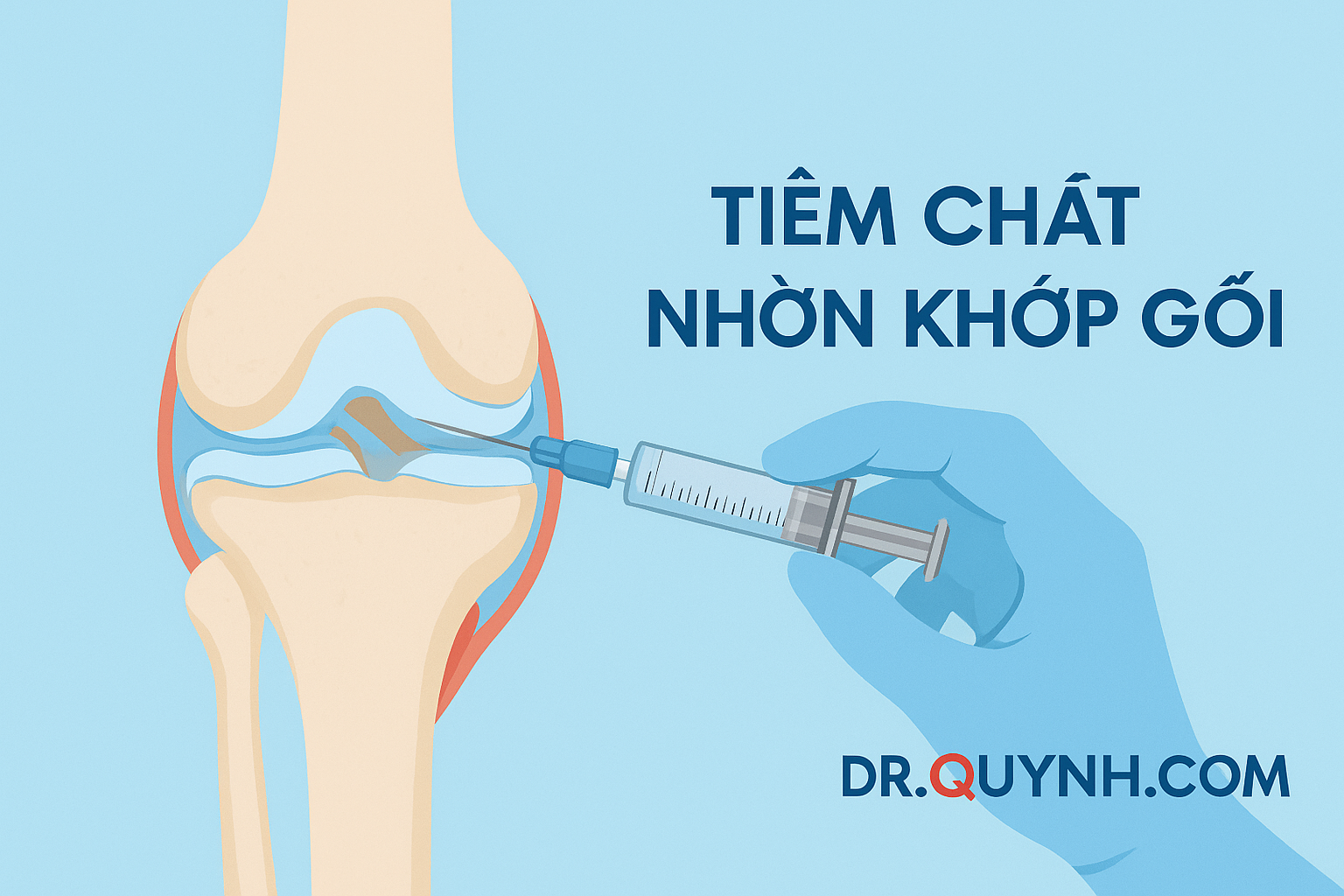 Tiêm chất nhờn khớp gối: Giải pháp giảm đau an toàn và hiệu quả