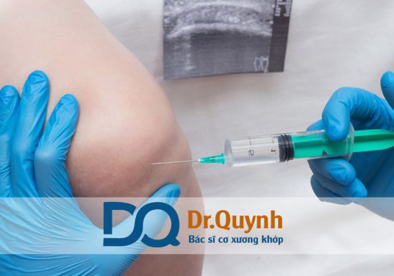 Tiêm chất nhờn khớp gối ở đâu uy tín là câu hỏi thường trực của những người đang bị thoái hóa khớp gối, đau nhức kéo dài, ảnh hưởng đến vận động.